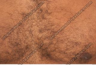 human skin hairy 0004